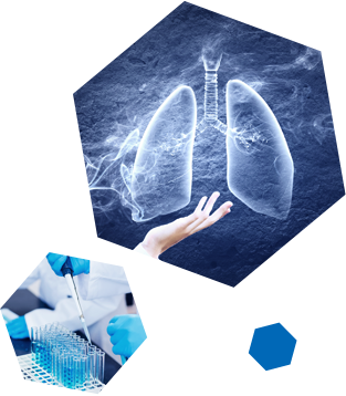 만성패쇄성 폐질환 COPD (PM014) 예시 이미지